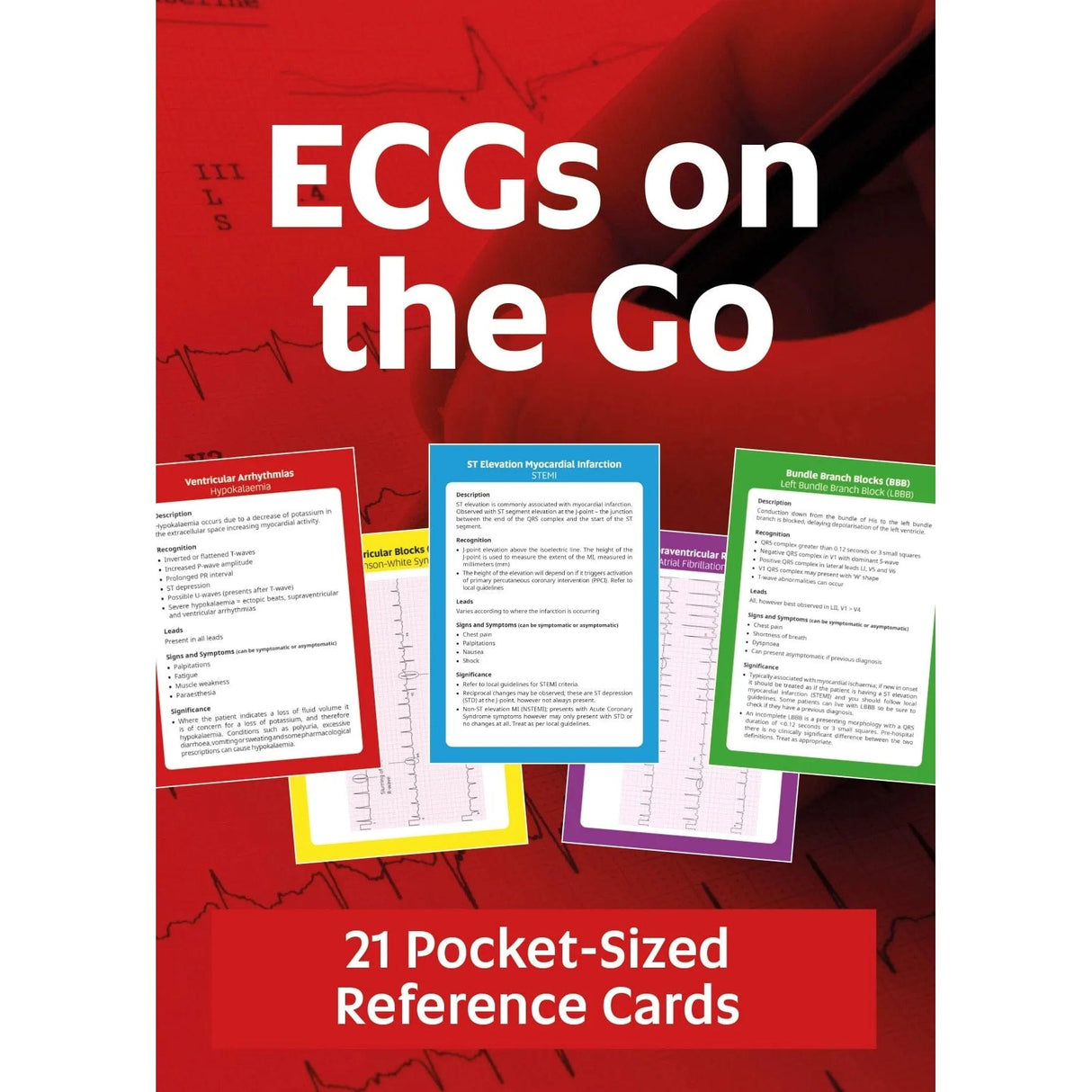 ECGs On The Go - 21 Pocket - Sized Reference Cards - Paramedic Shop