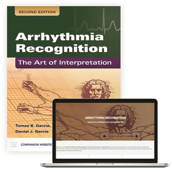 Paramedic Shop PSG Learning Textbooks Arrhythmia Recognition: The Art of Interpretation Second Edition